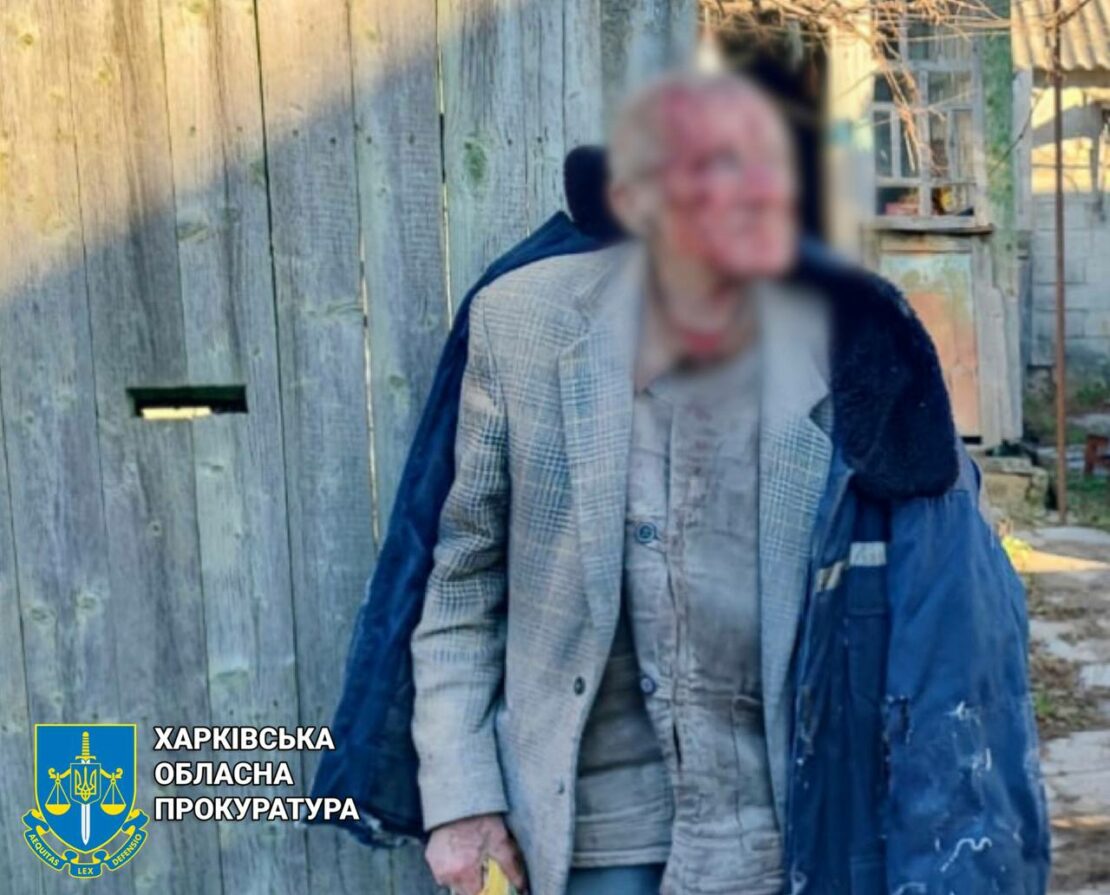 Уточнення про наслідки обстрілу Козачої Лопані на Харківщині